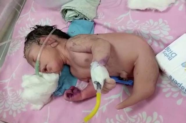 Doğumhanede bebeğin belden aşağısına bakan doktorlar gözlerine inanamadı: Aileyi hastaneden çıkarın