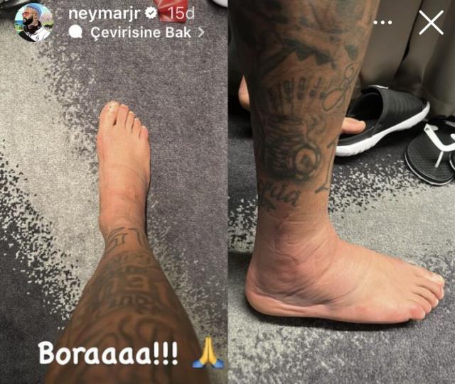 Görenler inanmakta güçlük çekiyor! Sakatlanan Neymar, ayağının içler acısı son halini paylaştı