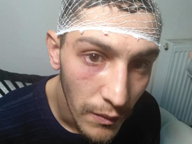 İş aramaya giden genç, 4 kişinin saldırısına uğradı! Önce darp sonra da gasp edildi