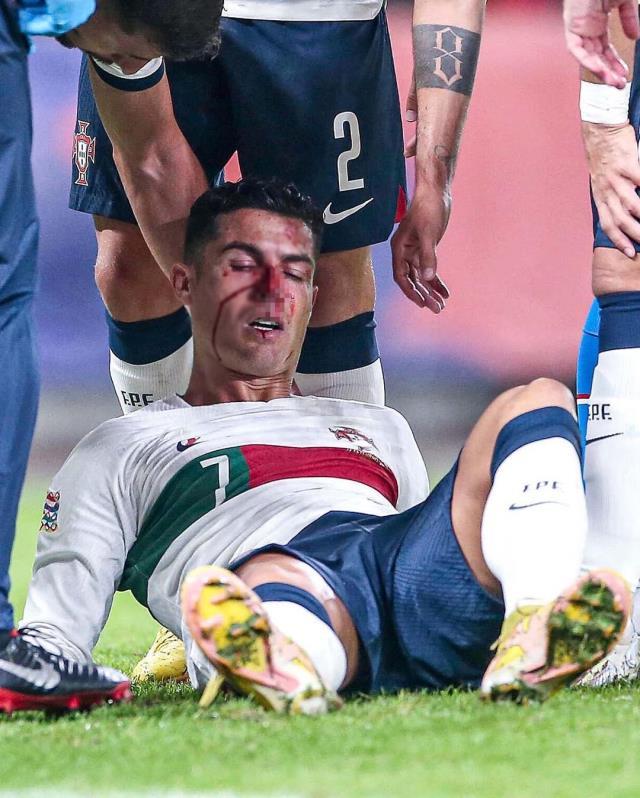 Savaştan çıkmış gibi! İşte kanlar içerisinde yerde kalan Ronaldo'nun son hali