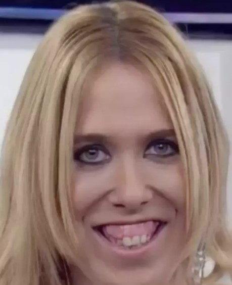 Wanda Nara meğer estetik harikasıymış! Eski halini görenler yüz nakli yaptırdı zannediyor