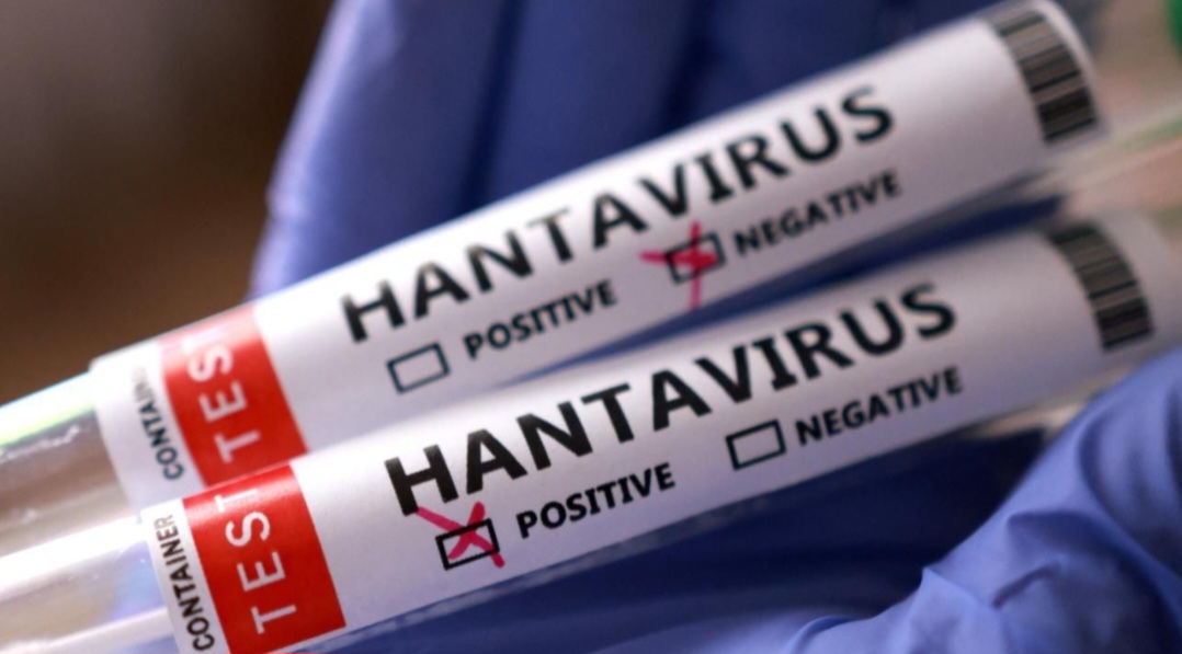 Sağlık Bakanlığı’ndan “hantavirüs” açıklaması