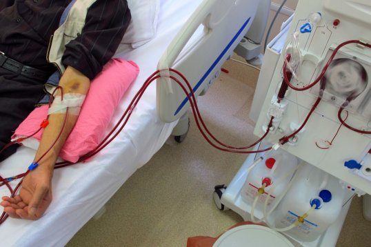 Antalya'da 18 Yıllık Diyaliz Hastasına Böbrek Nakli Yapıldı