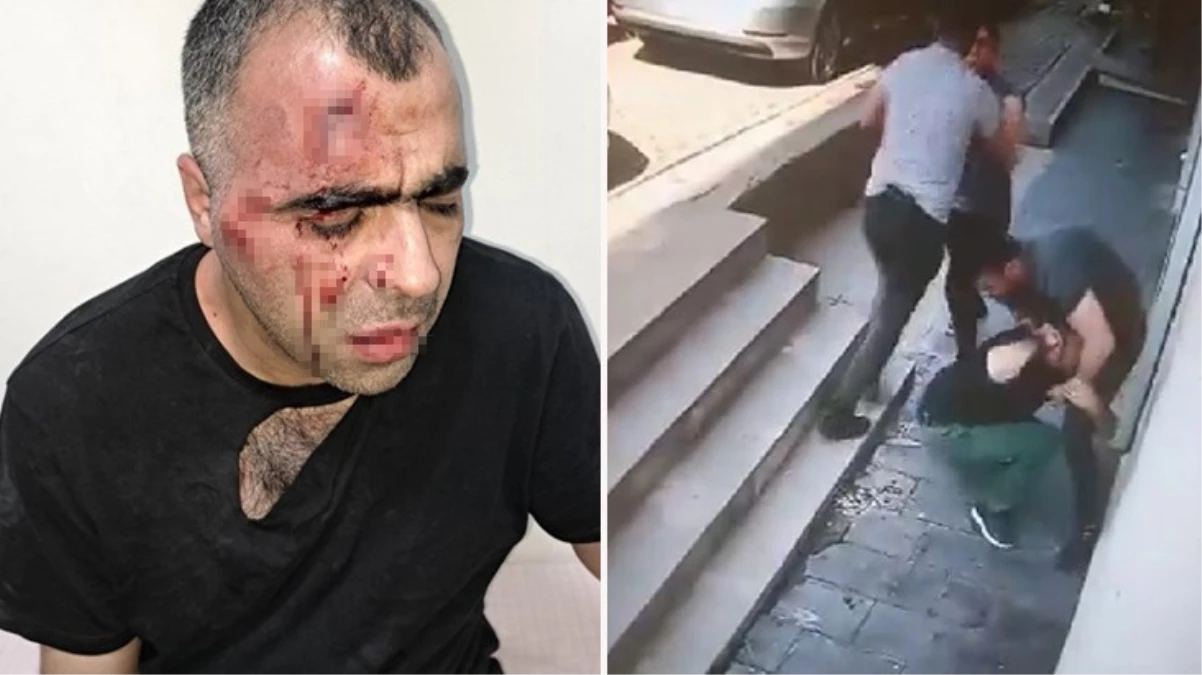 Gazeteci Sinan Aygül Tatvan'da saldırıya uğradı